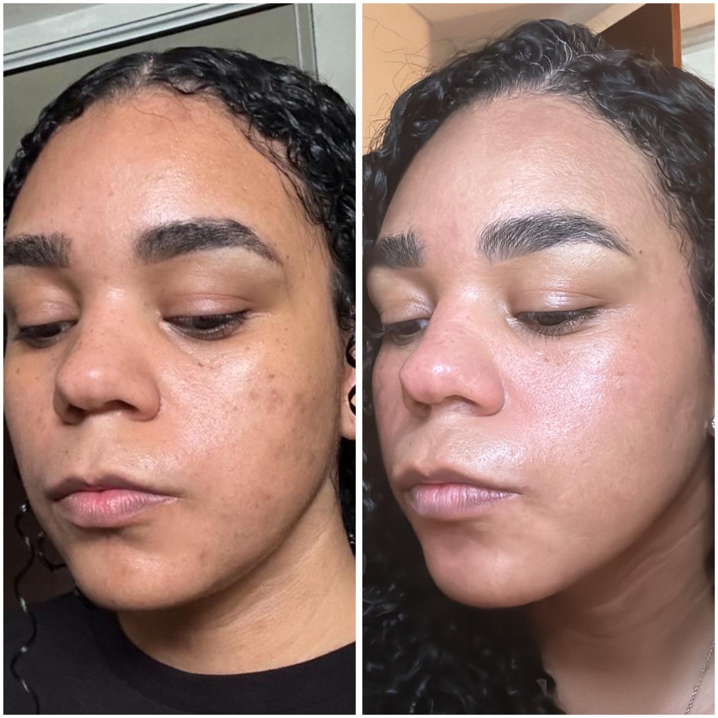 Hyaluronic Acid + Ceramides | Hydration Support Serum
